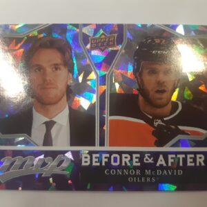2021-22 MVP Before & After Connor McDavid