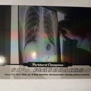 2022-2023 UD Parkhurst Champions 50´s Flashbacks Cinea 1950: First time X-Ray machine demonstrates moving picture process